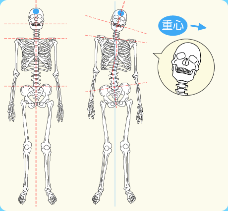 咬み合わせ、体のゆがみ